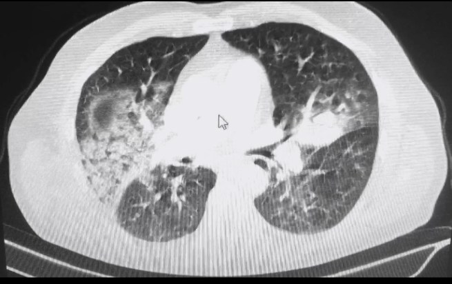 52D99078-754F-4474-8949-720C674AE610