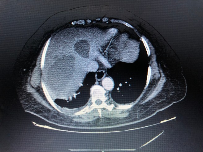 84F46D9D-48AE-41A6-B53B-8ACACD4078B0