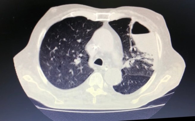 92E1E74B-1E50-4CFF-8973-2CD1CB9A6D50